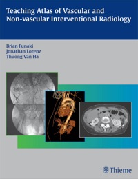 Cover image: Teaching Atlas of Vascular and Non-vascular Interventional Radiology 1st edition 9781588906250