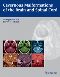 Cover image: Cavernous Malformations of the Brain and Spinal Cord 1st edition 9781588903433