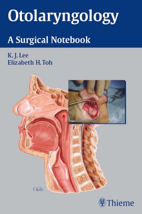 Otolaryngology: A Surgical Notebook, 1st  Edition - FULL INSTANT DOWNLOAD | PDF DOCX EPUB