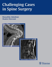 Omslagafbeelding: Challenging Cases in Spine Surgery 1st edition 9781588903938