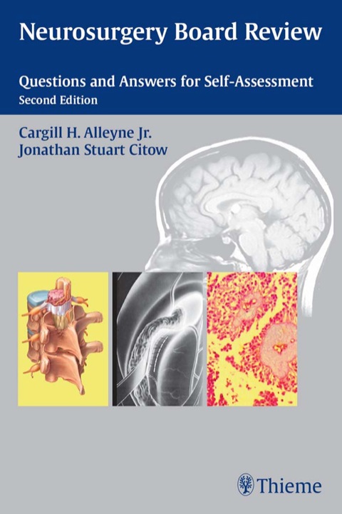 Neurosurgery Board Review: Questions and Answers for Self-Assessment, 2nd Edition - FULL INSTANT DOWNLOAD | PDF DOCX EPUB