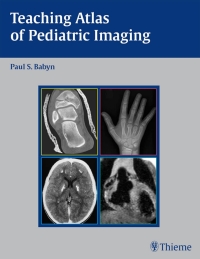 Cover image: Teaching Atlas of Pediatric Imaging 1st edition 9781588903396