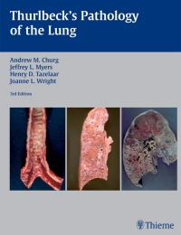 Omslagafbeelding: Thurlbeck's Pathology of the Lung 3rd edition 9781588902887