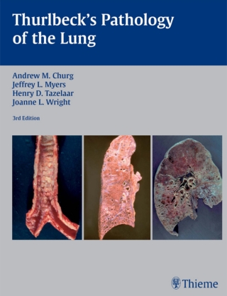 Imagen de portada: Thurlbeck's Pathology of the Lung 3rd edition 9781588902887