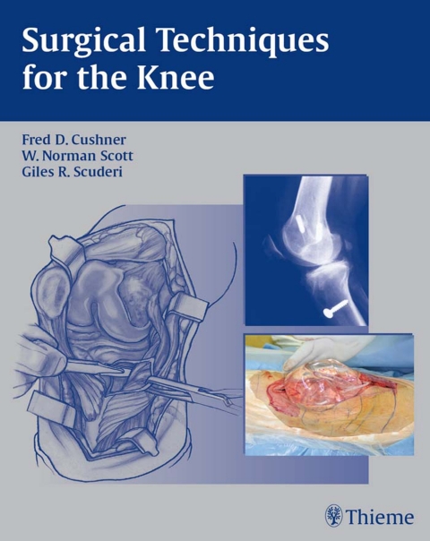 Surgical Techniques for the Knee, 1st  Edition - FULL INSTANT DOWNLOAD | PDF DOCX EPUB