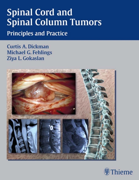Spinal Cord and Spinal Column Tumors: Principles and Practice, 1st Edition - FULL INSTANT DOWNLOAD | PDF DOCX EPUB