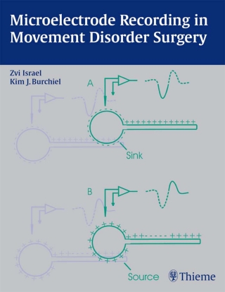 Imagen de portada: Microelectrode Recording in Movement Disorder Surgery 1st edition 9781588901743