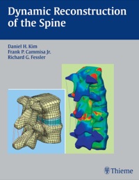 Cover image: Dynamic Reconstruction of the Spine 1st edition 9781604065084