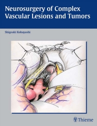 Cover image: Neurosurgery of Complex Vascular Lesions and Tumors 1st edition 9781588902245