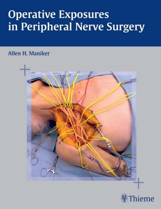 Cover image: Operative Exposures in Peripheral Nerve Surgery 1st edition 9781588902931