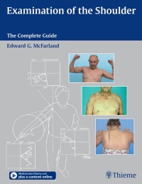 Cover image: Examination of the Shoulder 1st edition 9781588903716