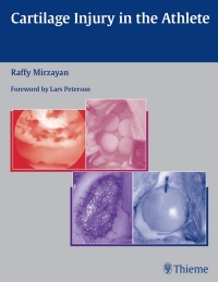 Cover image: Cartilage Injury in the Athlete 1st edition 9781588903051