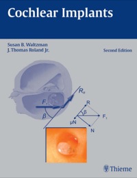 Imagen de portada: Cochlear Implants 2nd edition 9781604065350
