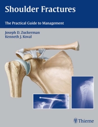 Imagen de portada: Shoulder Fractures 1st edition 9781588903105