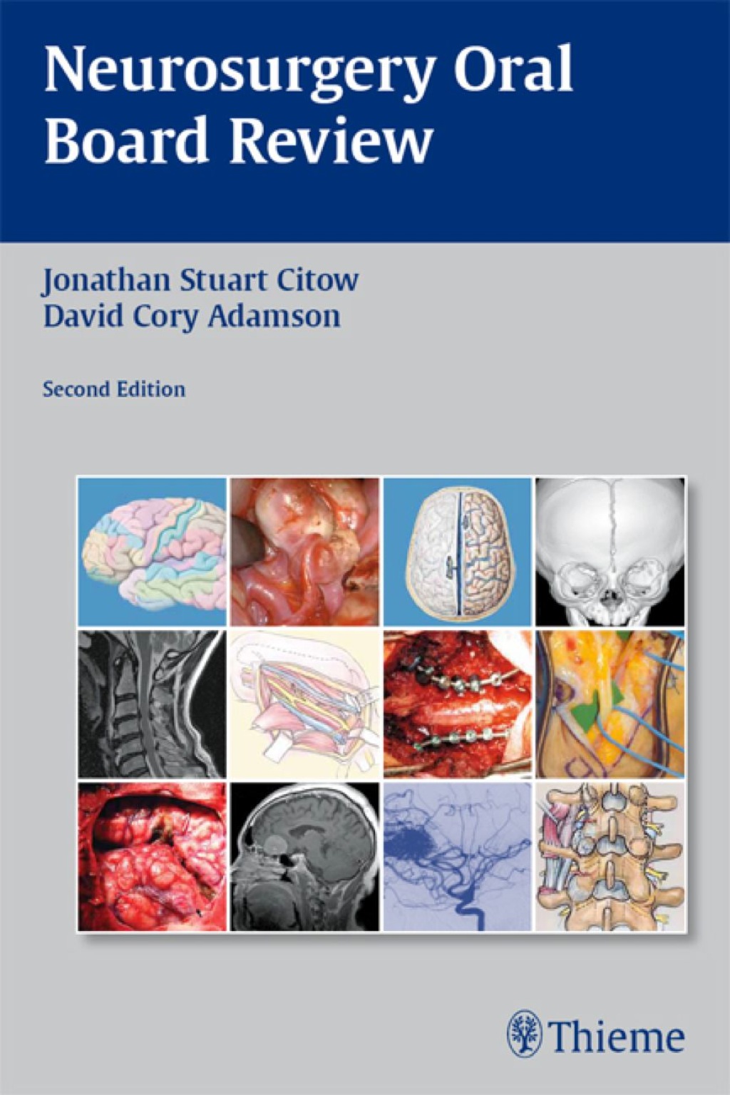 Neurosurgery Oral Board Review 2nd Edition