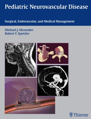 Cover image: Pediatric Neurovascular Disease 1st edition 9781588903686