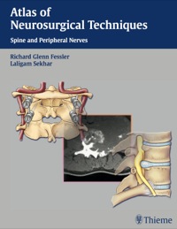 صورة الغلاف: Atlas of Neurosurgical Techniques 1st edition 9781604065558
