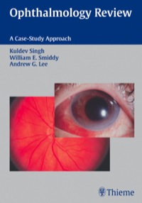 Cover image: Ophthalmology Review: A Case Study Approach 1st edition 9781604065565