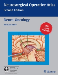 Cover image: Neuro-Oncology 2nd edition 9781588903402