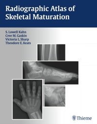 Cover image: Radiographic Atlas of Skeletal Maturation 1st edition 9781604065718