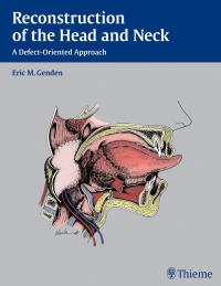 表紙画像: Reconstruction of the Head and Neck 1st edition 9781604065763