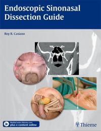 صورة الغلاف: Endoscopic Sinonasal Dissection Guide 1st edition 9781604065886