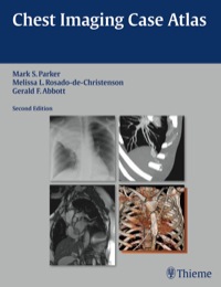 Cover image: Chest Imaging Case Atlas 2nd edition 9781604065909