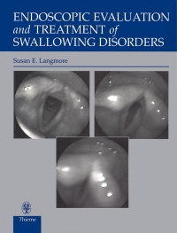 Cover image: Endoscopic Evaluation and Treatment of Swallowing Disorders 2nd edition 9780865778382