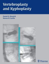 Omslagafbeelding: Vertebroplasty and Kyphoplasty 1st edition 9781588902276