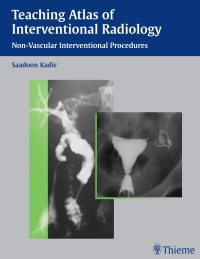 Imagen de portada: Teaching Atlas of Interventional Radiology 1st edition 9781588900562