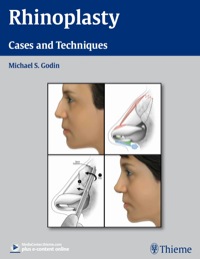 Imagen de portada: Rhinoplasty 1st edition 9781604066807