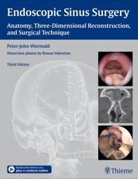 Cover image: Endoscopic Sinus Surgery: Anatomy, Three-Dimensional Reconstruction, and Surgical Technique 3rd edition 9781604066876