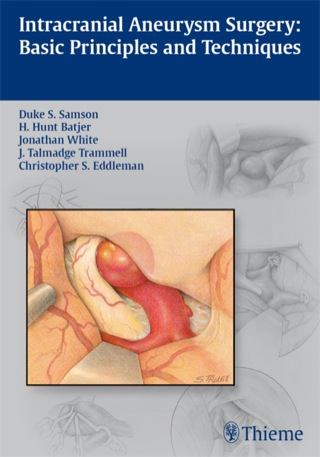 Cover image: Intracranial Aneurysm Surgery 1st edition 9781604066937