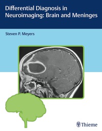 Titelbild: Differential Diagnosis in Neuroimaging: Brain and Meninges 1st edition 9781604067002