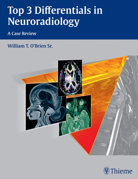 Top 3 Differentials in Neuroradiology, 1st  Edition - FULL INSTANT DOWNLOAD | PDF DOCX EPUB