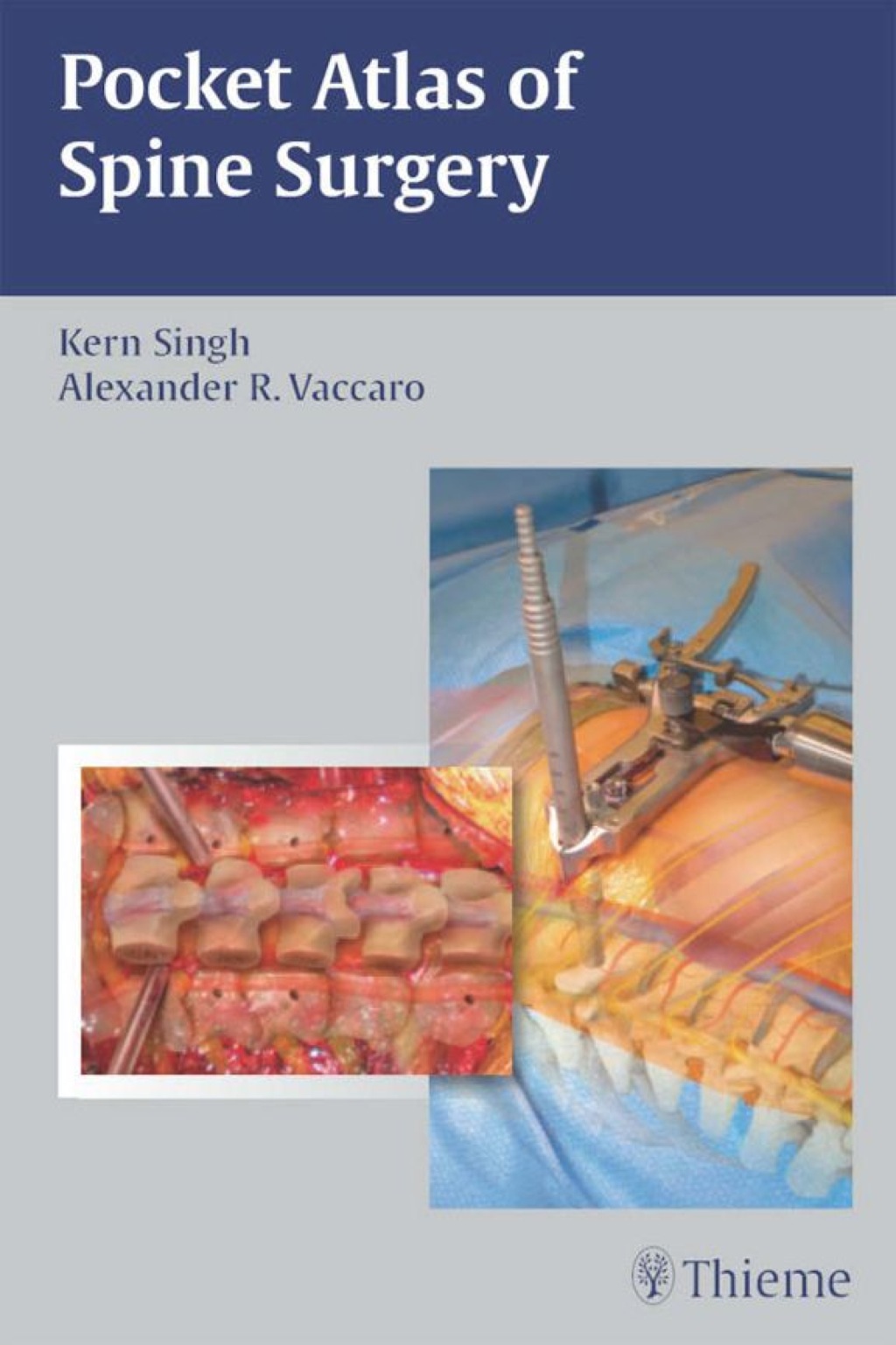 Pocket Atlas of Spine Surgery 1st Edition