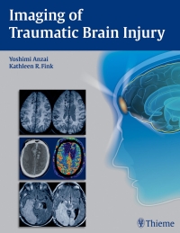 Cover image: Imaging of Traumatic Brain Injury 1st edition 9781604067286