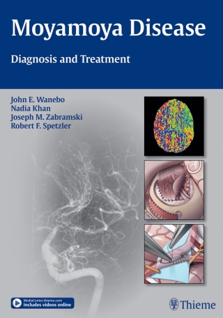 Imagen de portada: Moyamoya Disease 1st edition 9781604067309