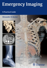 Cover image: Emergency Imaging 1st edition 9781604067422