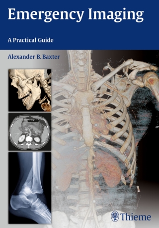 Immagine di copertina: Emergency Imaging 1st edition 9781604067422