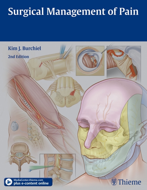 Surgical Management of Pain, 2nd  Edition - FULL INSTANT DOWNLOAD | PDF DOCX EPUB