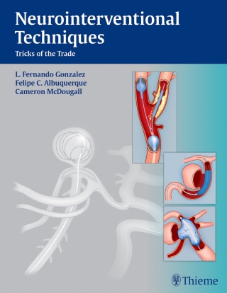 Cover image: Neurointerventional Techniques 1st edition 9781604067576