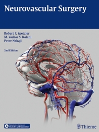 Titelbild: Neurovascular Surgery 2nd edition 9781604067590