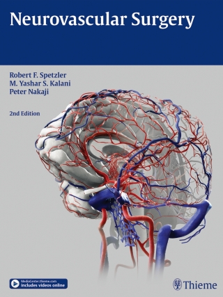 Cover image: Neurovascular Surgery 2nd edition 9781604067590