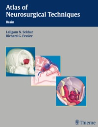 Titelbild: Atlas of Neurosurgical Techniques 1st edition 9780865779204