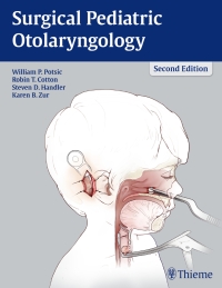 Immagine di copertina: Surgical Pediatric Otolaryngology 2nd edition 9781604067729