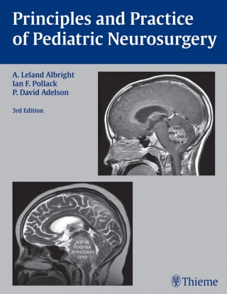 صورة الغلاف: Principles and Practice of Pediatric Neurosurgery 3rd edition 9781604067996