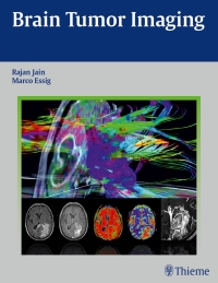 Imagen de portada: Brain Tumor Imaging 1st edition 9781604068061