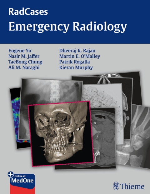 Radcases Emergency Radiology, 1st  Edition - FULL INSTANT DOWNLOAD | PDF DOCX EPUB