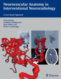 Imagen de portada: Neurovascular Anatomy in Interventional Neuroradiology 1st edition 9781604068399